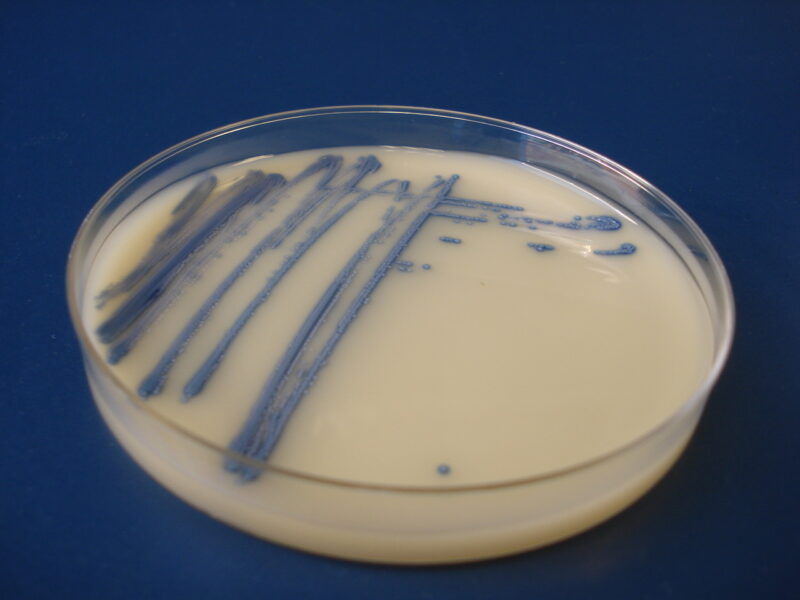 Abb 1 Methicillin resistenter Staphylococcus aureus auf Selektivmedium
