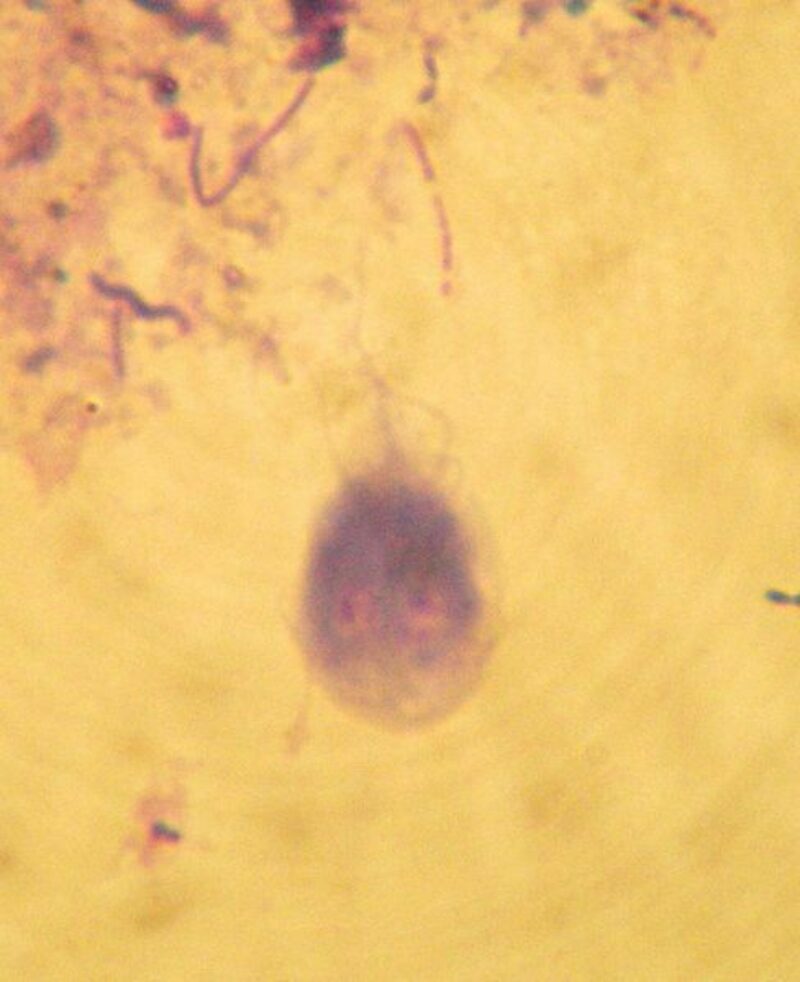 488px Giardia intestinalis dog