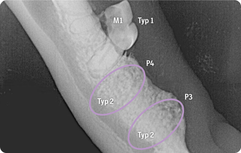 Zahnresorption3 0