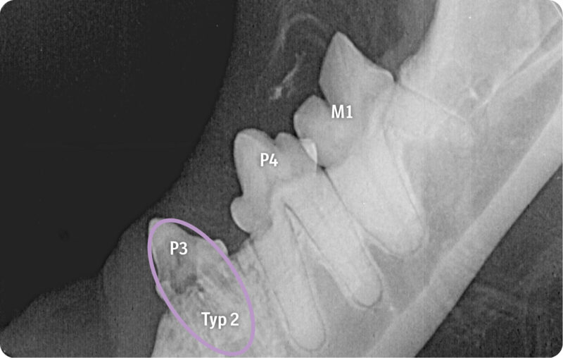 Zahnresorption 0